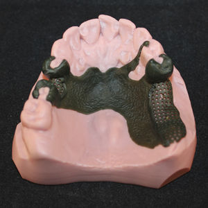resina per stampante 3D polimerica / odontoiatrica