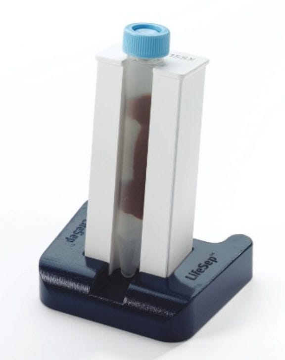 Separatore Magnetico A Penetrazione Magnetica Profonda Per La Rimozione Del Ferro Dal Produttore