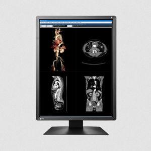 monitor LCD