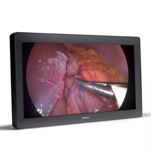 display TFT LCD