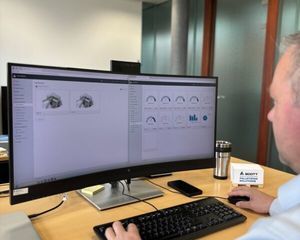 pacchetto di software di ERP 1