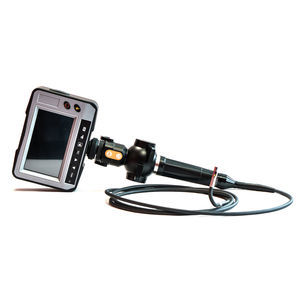 video-endoscopio flessibile