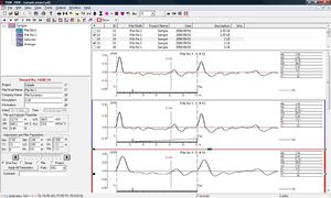 soluzione software di calcolo
