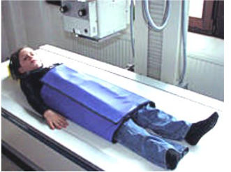 Copertura di protezione per radioscopia - Lanz-Anliker AG