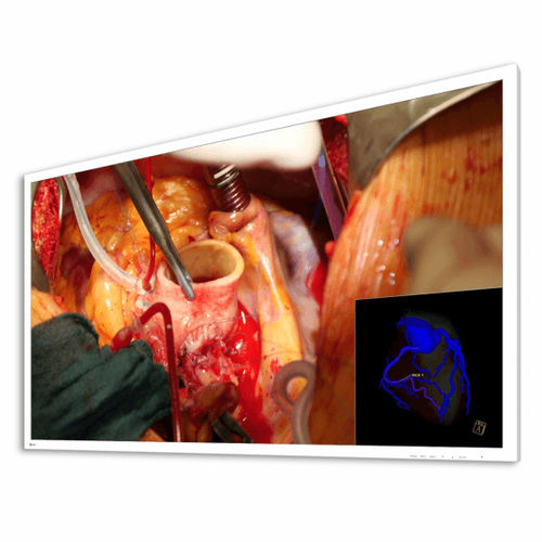 Monitor TFT-LCD - EX5841 - EIZO NANAO - con retroilluminazione a LED / di protezione / per il settore medico