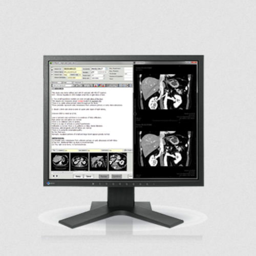 Monitor LCD - MX194 - EIZO NANAO - con retroilluminazione a LED / digitale / per il settore medico