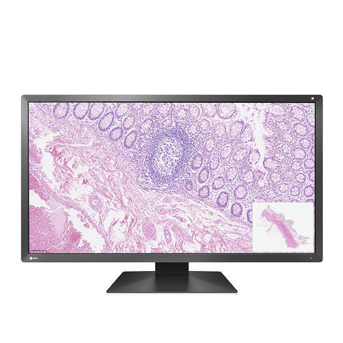 Monitor LCD - PX3150 - EIZO NANAO - con retroilluminazione a LED / di visualizzazione / per il settore medico