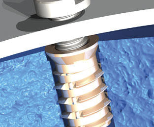 Inserto filettato - Foamsert® - TAPPEX - di ottone / piatto