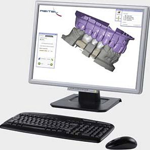 Software di interfaccia - exocad  - Reitel - di progettazione / di pianificazione / per odontoiatria