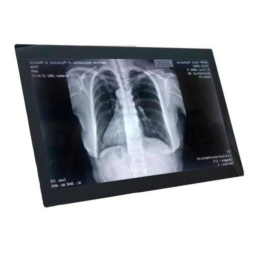 Monitor per il settore medico - HSINTEK Electronics Co., Ltd - LCD / con retroilluminazione a LED / per applicazioni igieniche