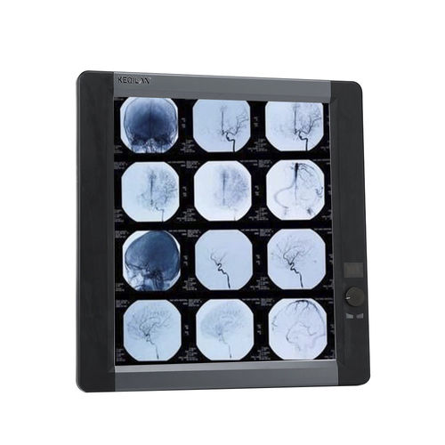 Negatoscopio industriale LED - YMY0919D - LINYI FULANG TRADING CO., LTD.