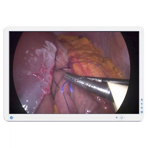 Display LED -  AMM240ED - Barco - 24" / per apparecchiatura medica / RGB