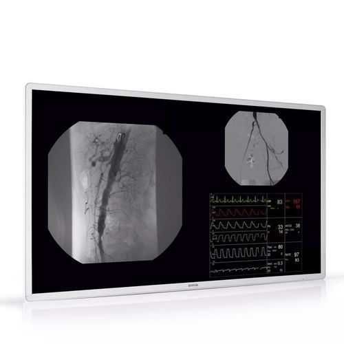 Display IPS - MDAC‑8355 - Barco - ad alta definizione / UHD / 55"