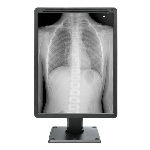 Display informativo medico - MDC-G2201 - ZRT Technology - monocromatico / 21.3" / HDMI