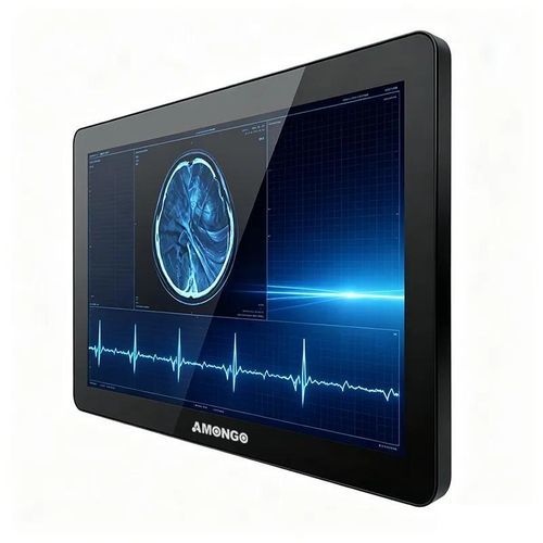 Monitor con touch screen - AMG-15OPTD01G1 - AMONGO Display Technology(ShenZhen)Co.,LTD - con retroilluminazione a LED / per il settore medico / 15,6"