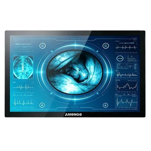 Monitor touch screen - AMG-32OPGER1G2 - AMONGO Display Technology(ShenZhen)Co.,LTD - con retroilluminazione a LED / per il settore medico / 32"