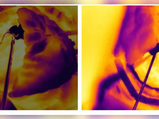 Imaging termico a infrarossi utilizzato nel monitoraggio medico e sanitario