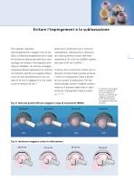 BIOLOX® – La Ceramica per l’artoprotesi dell’anca - 7