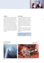 BIOLOX®delta – La nuova ceramica nanocomposita per le artroprotesi - 3